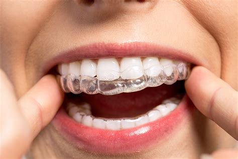 Magical Orthodontics: Straight Teeth Made Easy